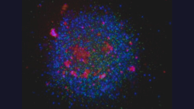 tumor cells, immune cells, and dead cells 