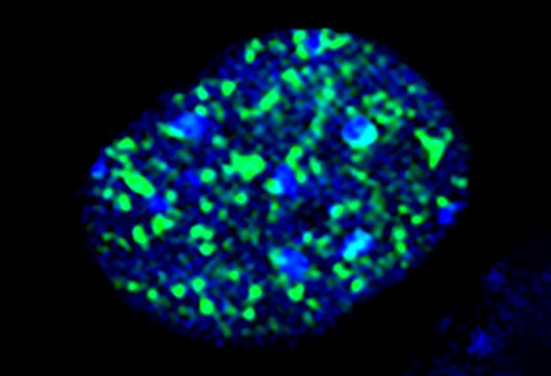 Blue and green microscopy image of brain tumor cells treated with 2 drugs: LMP400 and Niraparib